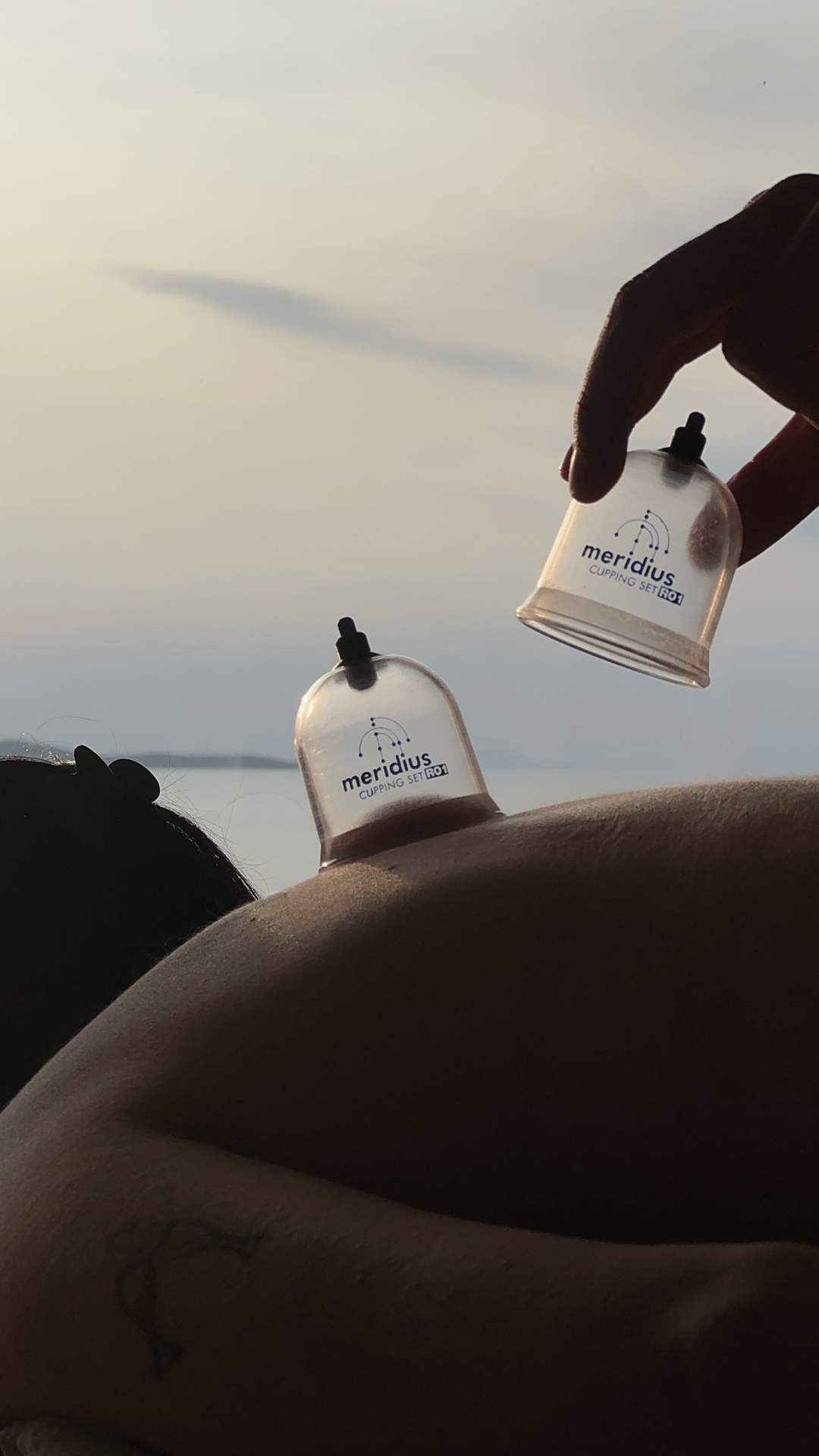 Cupping Therapy